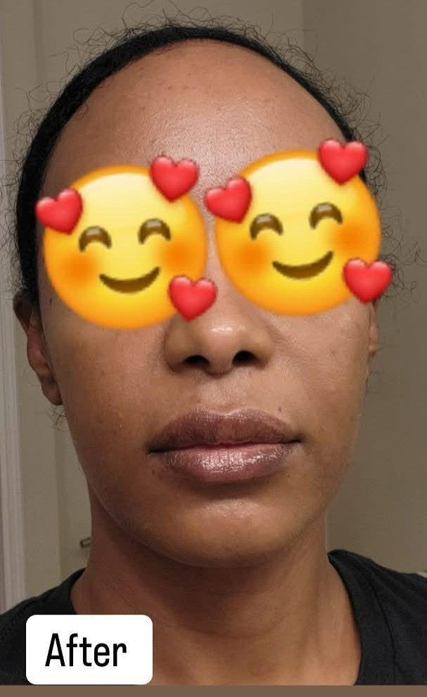 After You Glow Serum