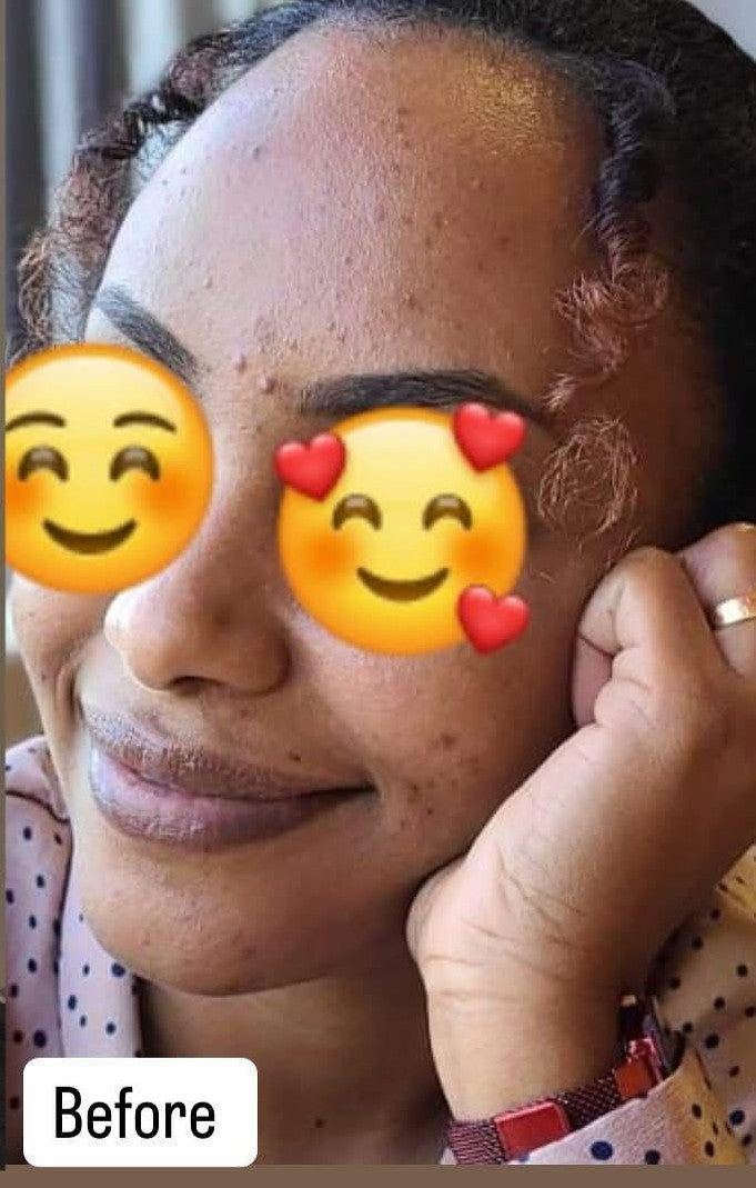 Before You Glow Serum