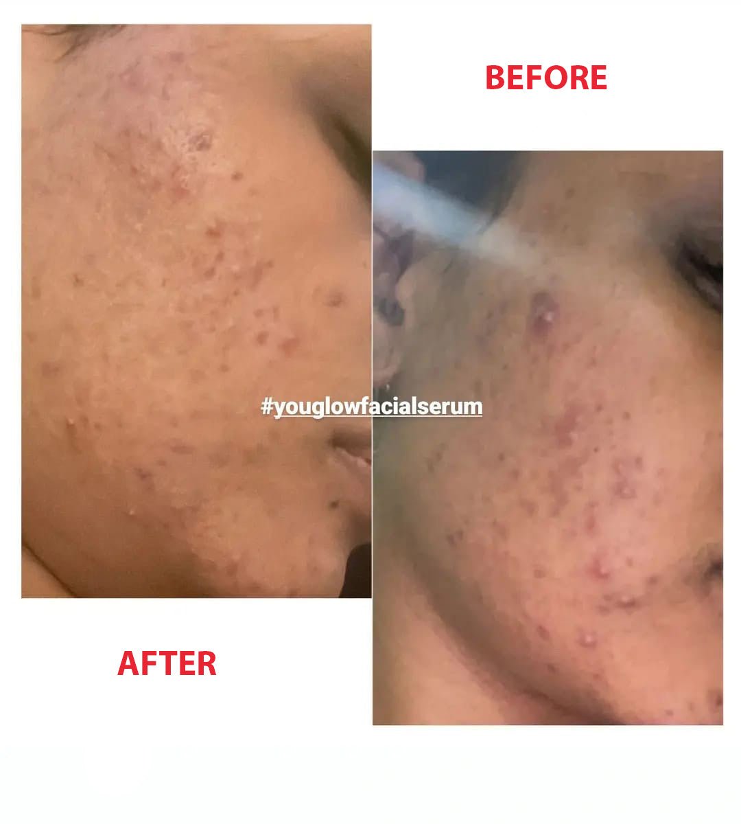 YouGlow Extra – Advanced Brightening & Nourishing Facial Oil Serum - MKADI