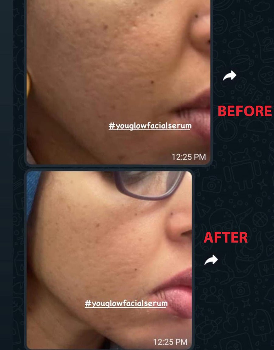 YouGlow Extra – Advanced Brightening & Nourishing Facial Oil Serum - MKADI