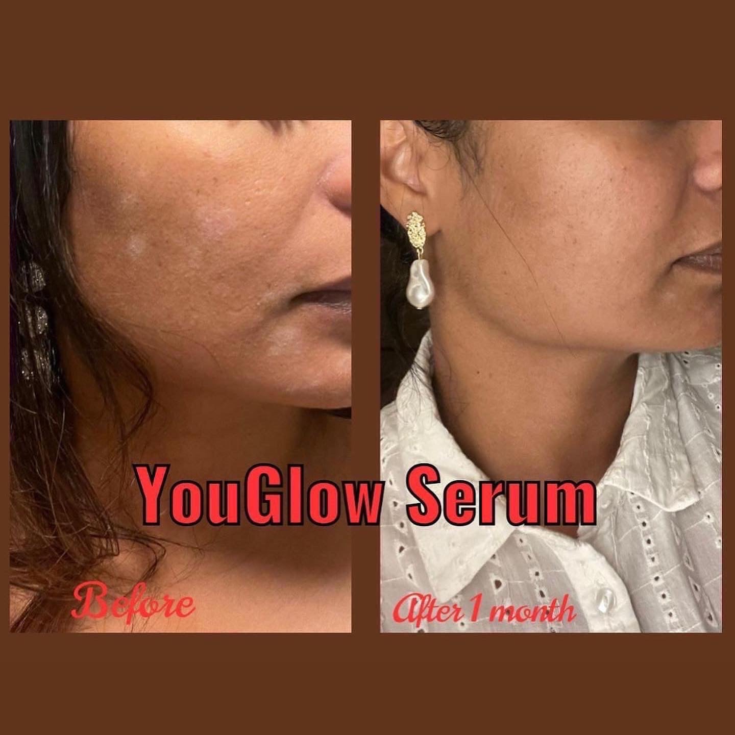 YouGlow Extra – Advanced Brightening & Nourishing Facial Oil Serum - MKADI