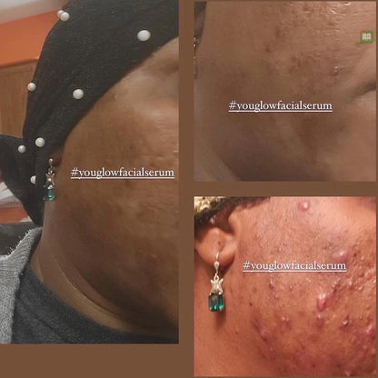 YouGlow Extra – Advanced Brightening & Nourishing Facial Oil Serum - MKADI