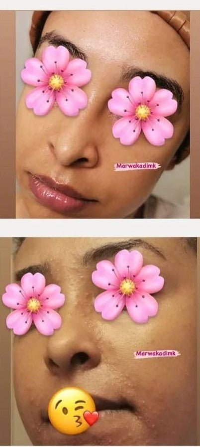 YouGlow Extra – Advanced Brightening & Nourishing Facial Oil Serum - MKADI